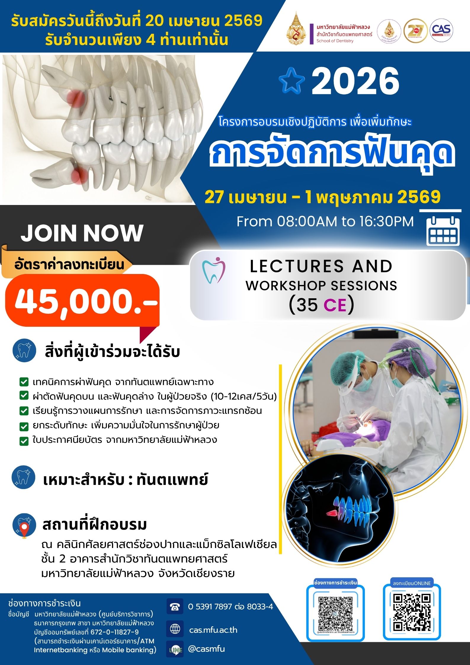 ปิดรับสมัคร ที่นั่งเต็มแล้วค่ะ 27 เมษายน – 1 พฤษภาคม 2569 | โครงการอบรมเชิงปฏิบัติการ การจัดการฟันคุด (Impacted Tooth Management) ปี 2026